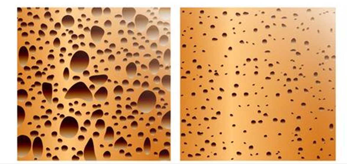 Comparison of porous osteoporotic bone and denser healthy bone